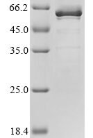 Human Transcription factor 7 (TCF7) Recombinant Protein - BioCrest Sci