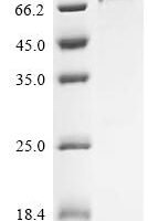 Human Protein mono-ADP-ribosyltransferase PARP10 (PARP10), partial Recombinant Protein - BioCrest Sci