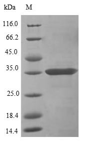 Mouse C-type lectin domain family 12 member A (Clec12a), partial Recombinant Protein, N-10His/C-Myc, aa 65–267, E.coli, Mus musculus (Mouse), E.coli, N-terminal 10xHis-tagged and C-terminal Myc-tagged, 30.8 kDa, purity >≥ 85% as determined by SDS-PAGE.