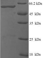 Bacillus subtilis Glycine oxidase (thiO) Recombinant Protein - BioCrest Sci