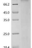 Mouse Interleukin-13 (Il13) Recombinant Protein, N-His, aa 19–131, Yeast - BioCrest Sci