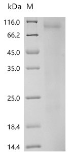 Mouse Interleukin-13 (Il13) Recombinant Protein, N-His, aa 19–131, Yeast, Mus musculus (Mouse), Yeast, N-terminal 6xHis-tagged, 14.4 kDa, purity >≥ 95% as determined by SDS-PAGE.