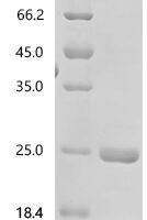 Riemerella anatipestifer RA-CH-1 Outer membrane receptor for ferrienterochelin and colicins (B739_1416), partial Recombinant Protein - BioCrest Sci