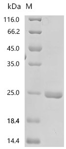 Riemerella anatipestifer RA-CH-1 Outer membrane receptor for ferrienterochelin and colicins (B739_1416), partial Recombinant Protein, Riemerella anatipestifer RA-CH-1, E.coli, N-terminal 6xHis-tagged, 22.9 kDa, purity >≥ 95% as determined by SDS-PAGE.