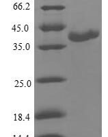 Human Calmodulin-like protein 3 (CALML3) Recombinant Protein - BioCrest Sci