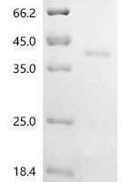 Mouse Transforming growth factor beta-1 proprotein (Tgfb1), partial Recombinant Protein, N-hFc1 - BioCrest Sci
