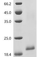 Human Protein ADM2 (ADM2), partial Recombinant Protein, N-His-SUMOstar - BioCrest Sci