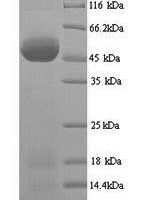 African cassava mosaic virus Replication-associated protein (AC1) Recombinant Protein, N-His - BioCrest Sci