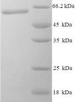 Bacillus subtilis Modification methylase BglII (bglIIM) Recombinant Protein - BioCrest Sci