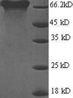 Helicobacter pylori Urease subunit beta (ureB) Recombinant Protein, N-His, aa 1–569, E.coli - BioCrest Sci