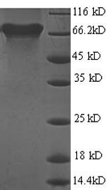 Helicobacter pylori Urease subunit beta (ureB) Recombinant Protein, N-His, aa 1–569, E.coli, Helicobacter pylori (strain ATCC 700392 / 26695) (Campylobacter pylori), E.coli, N-terminal 6xHis-tagged, 65.7 kDa, purity >≥ 90% as determined by SDS-PAGE.