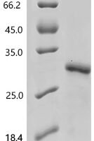 Ctenocephalides felis Salivary antigen 1 Recombinant Protein, N-His, aa 19–176, E.coli - BioCrest Sci