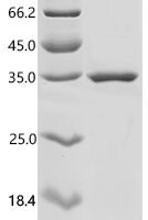 Human Anosmin-1 (ANOS1), partial Recombinant Protein - BioCrest Sci