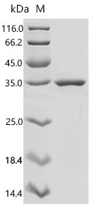 Human Anosmin-1 (ANOS1), partial Recombinant Protein, Homo sapiens (Human), E.coli, C-terminal 6xHis-tagged, 33.3 kDa, purity >≥ 85% as determined by SDS-PAGE.