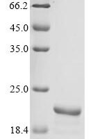 Rat D-dopachrome decarboxylase (Ddt) Recombinant Protein, N-10His/C-Myc - BioCrest Sci