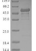 Human Nicotinamide mononucleotide adenylyltransferase 1 (NMNAT1) Recombinant Protein - BioCrest Sci