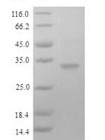 Human Fc receptor-like protein 6 (FCRL6), partial Recombinant Protein - BioCrest Sci