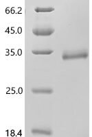 Human Kallikrein-2 (KLK2), Biotinylated Recombinant Protein - BioCrest Sci
