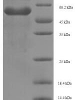 Saccharomyces cerevisiae Alanine/arginine aminopeptidase (AAP1), partial Recombinant Protein - BioCrest Sci