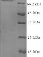 Human Tissue-type plasminogen activator (PLAT), partial Recombinant Protein - BioCrest Sci