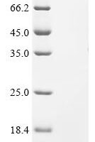 Human Cytochrome c oxidase subunit FA4 (COXFA4), partial Recombinant Protein, C-His - BioCrest Sci