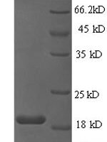 Human papillomavirus type 16 Protein E6 (E6) Recombinant Protein, N-His, aa 1–158, E.coli - BioCrest Sci