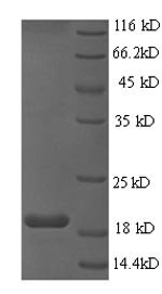 Human papillomavirus type 16 Protein E6 (E6) Recombinant Protein, N-His, aa 1–158, E.coli, Human papillomavirus type 16, E.coli, N-terminal 6xHis-tagged, 23.2 kDa, purity >≥ 90% as determined by SDS-PAGE.