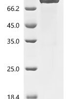 Mouse Muscle, skeletal receptor tyrosine-protein kinase (Musk), partial Recombinant Protein, C-hFc1 - BioCrest Sci