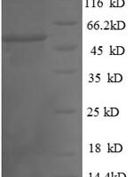 Human Thiopurine S-methyltransferase (TPMT), partial Recombinant Protein - BioCrest Sci