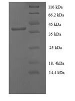 Human papillomavirus type 16 Protein E7 (E7) Recombinant Protein, N-GST - BioCrest Sci