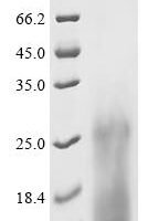 Mycobacterium bovis ESAT-6-like protein esxB (esxB) Recombinant Protein, C-His, aa 2–100, Yeast - BioCrest Sci