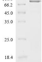 Human Lactotransferrin (LTF) Recombinant Protein, C-His, aa 20–710, Yeast - BioCrest Sci