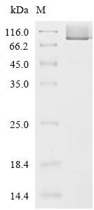 Human Lactotransferrin (LTF) Recombinant Protein, C-His, aa 20–710, Yeast, Yeast, C-terminal 6xHis-tagged, 77.7 kDa, purity >≥ 95% as determined by SDS-PAGE.