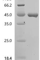Stenotrophomonas maltophilia Dicamba O-demethylase, oxygenase component (ddmC) Recombinant Protein, C-His, aa 2–339, E.coli - BioCrest Sci