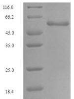 Human Glutaminase kidney isoform, mitochondrial (GLS), partial Recombinant Protein, N-GST, aa 370–669 - BioCrest Sci