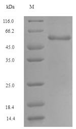 Human Glutaminase kidney isoform, mitochondrial (GLS), partial Recombinant Protein, N-GST, aa 370–669, Homo sapiens (Human), E.coli, N-terminal GST-tagged, 60.4 kDa, purity >≥ 90% as determined by SDS-PAGE.
