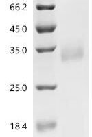 Human Ly-6/neurotoxin-like protein 1 (LYNX1) Recombinant Protein, N-His-SUMOstar, Mature - BioCrest Sci