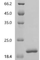 Simian retrovirus SRV-1 Gag polyprotein (gag), partial Recombinant Protein, C-His, aa 2–100, E.coli - BioCrest Sci