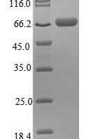 Human Thyroid hormone receptor alpha (THRA) Recombinant Protein - BioCrest Sci