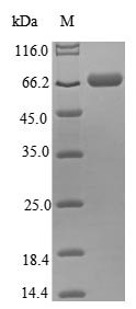 Human Thyroid hormone receptor alpha (THRA) Recombinant Protein, Homo sapiens (Human), E.coli, N-terminal 6xHis-B2M-tagged, 68.8 kDa, purity >≥ 85% as determined by SDS-PAGE.