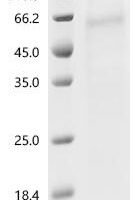 Human 1-acylglycerol-3-phosphate O-acyltransferase PNPLA3 (PNPLA3) ((I148M)) Recombinant Protein - BioCrest Sci