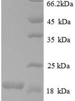 Human Bone morphogenetic protein 6 (BMP6), partial Recombinant Protein - BioCrest Sci
