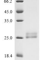 Human Lymphotoxin-alpha (LTA), partial,Biotinylated Recombinant Protein - BioCrest Sci
