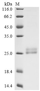 Human Lymphotoxin-alpha (LTA), partial,Biotinylated Recombinant Protein, Homo sapiens (Human), Mammalian cell, N-terminal 6xHis-Avi-tagged, 22.7 kDa, purity >≥ 90% as determined by SDS-PAGE.