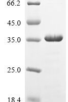 Human Myosin regulatory light chain 12A (MYL12A) Recombinant Protein, N-His-SUMO - BioCrest Sci