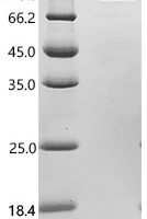 Human Transferrin receptor protein 1 (TFRC), partial, Biotinylated Recombinant Protein - BioCrest Sci