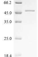Mouse Calpain-3 (Capn3), partial Recombinant Protein, N-His, aa 46–419, E.coli - BioCrest Sci