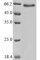 Human Tissue-type plasminogen activator (PLAT) (R497Q) Recombinant Protein - BioCrest Sci
