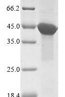 Human Actin-like protein 8 (ACTL8) Recombinant Protein, N-10His/C-Myc - BioCrest Sci