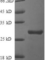 Human Clusterin (CLU), partial Recombinant Protein - BioCrest Sci